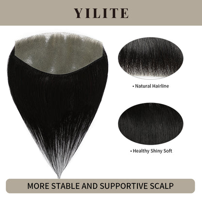 Realmhair seamless hair patch 7x15cm with natural hairline and healthy, shiny, soft hair (#1 Jet Black)