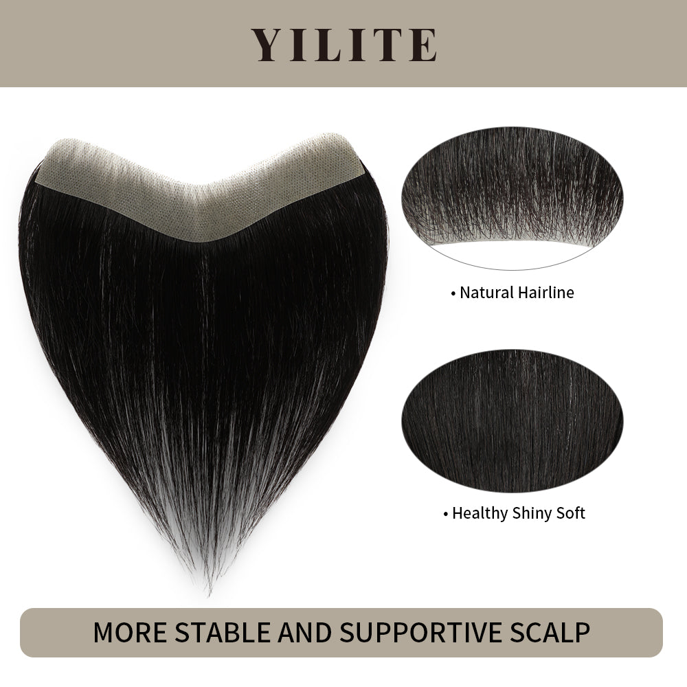 Realmhair seamless hair patch 2.5x16cm with natural hairline and healthy, shiny, soft hair (#1£©