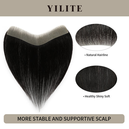 Realmhair seamless hair patch 2.5x16cm with natural hairline and healthy, shiny, soft hair (#1£©