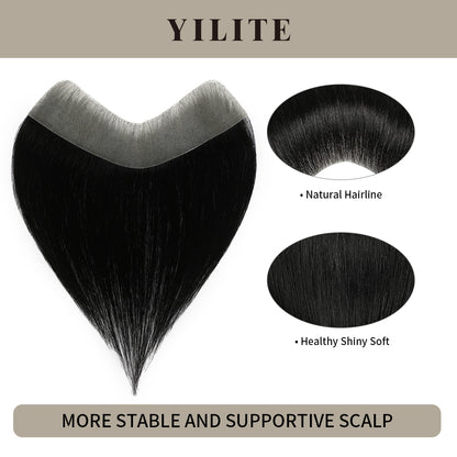 Realmhair seamless hair patch 3x16cm with natural hairline and healthy, shiny, soft hair (#1 Jet Black£©
